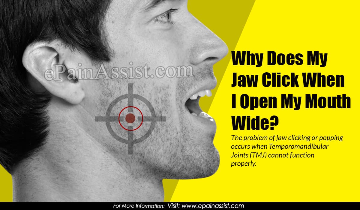 Why Does My Jaw Click When I Open My Mouth Wide?