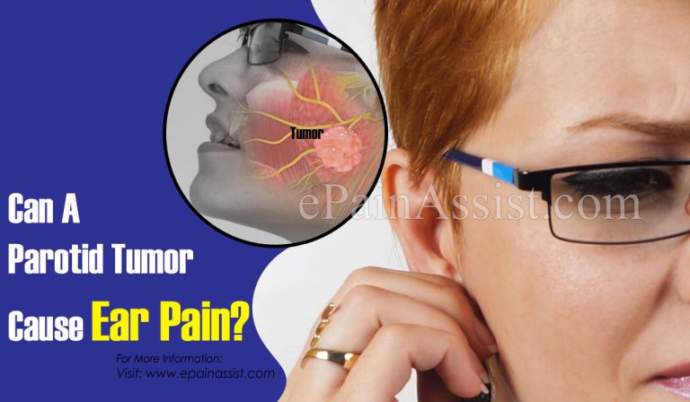 Can A Parotid Tumor Cause Ear Pain & Are They Hereditary?
