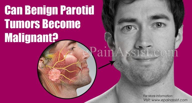 Can Benign Parotid Tumors Become Malignant & How Big Are Tumors?