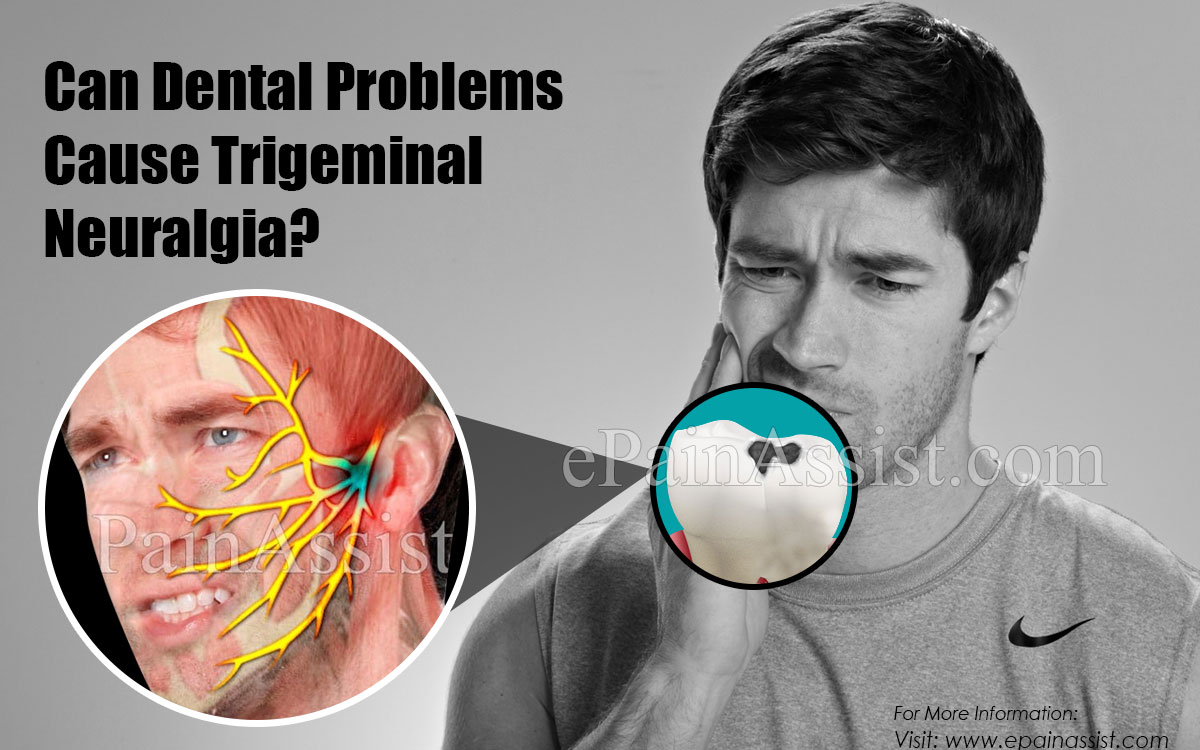 Can Dental Problems Cause Trigeminal Neuralgia What About Bell S Palsy