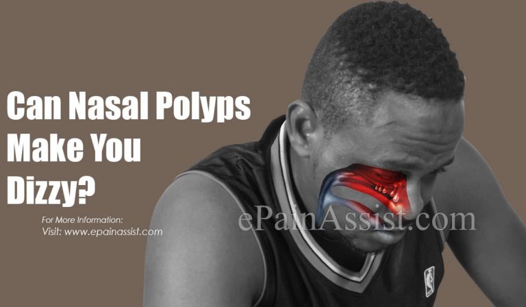 Can Nasal Polyps Make You Dizzy & Can They Cause Fatigue?