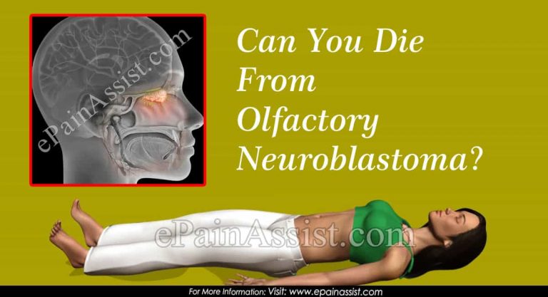 Can You Die From Olfactory Neuroblastoma & How Do You Stop It From Spreading?