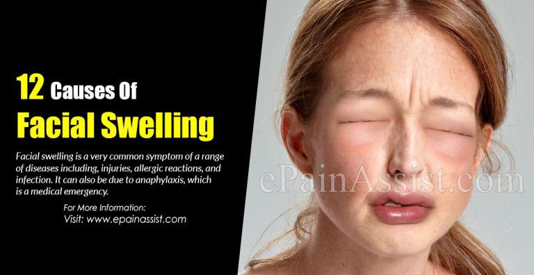 12 Causes Of Facial Swelling