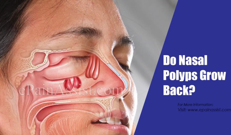 Do Nasal Polyps Grow Back & How To Prevent It?