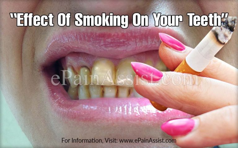 Effect of Smoking on Teeth &  Do The Teeth Get Better If You Quit Smoking?