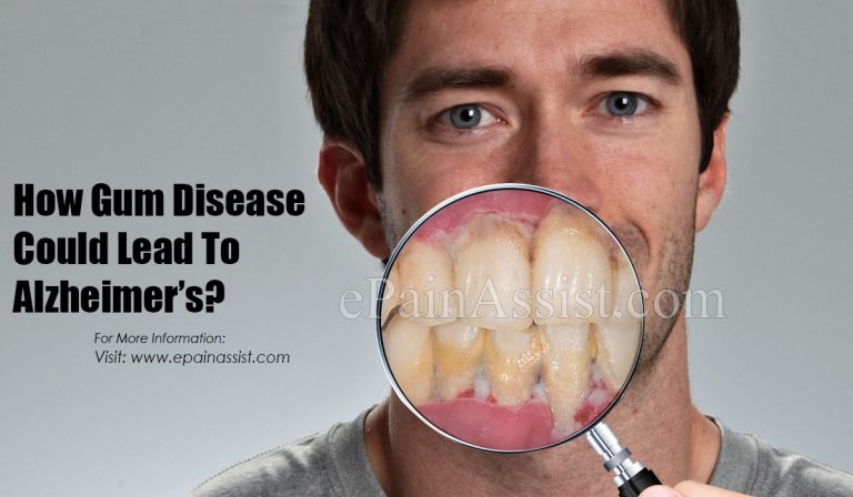 How Gum Disease Could Lead To Alzheimer’s?