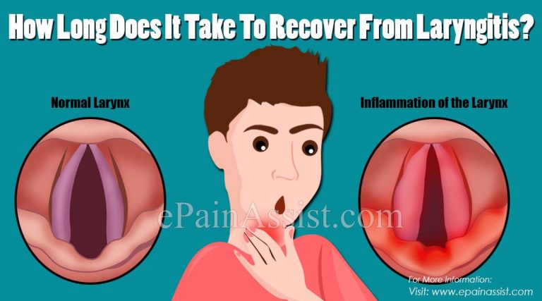 How Long Does It Take To Recover From Laryngitis?