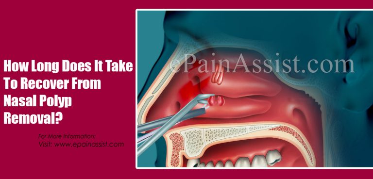 How Long Does It Take To Recover From Nasal Polyp Removal?