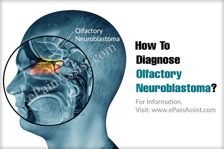 How To Diagnose Olfactory Neuroblastoma & What Is The Best Medicine For It?