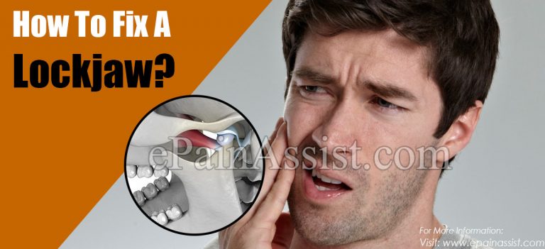 How To Fix A Lockjaw?