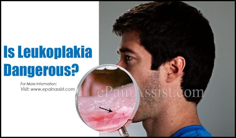 Is Leukoplakia Dangerous?