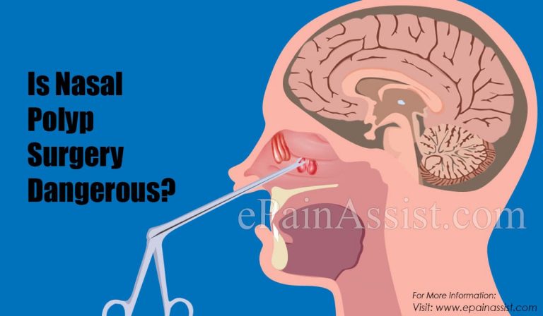 Is Nasal Polyp Surgery Dangerous?