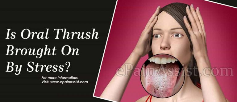 Is Oral Thrush Brought On By Stress & Can It Be Mistaken For Something Else?
