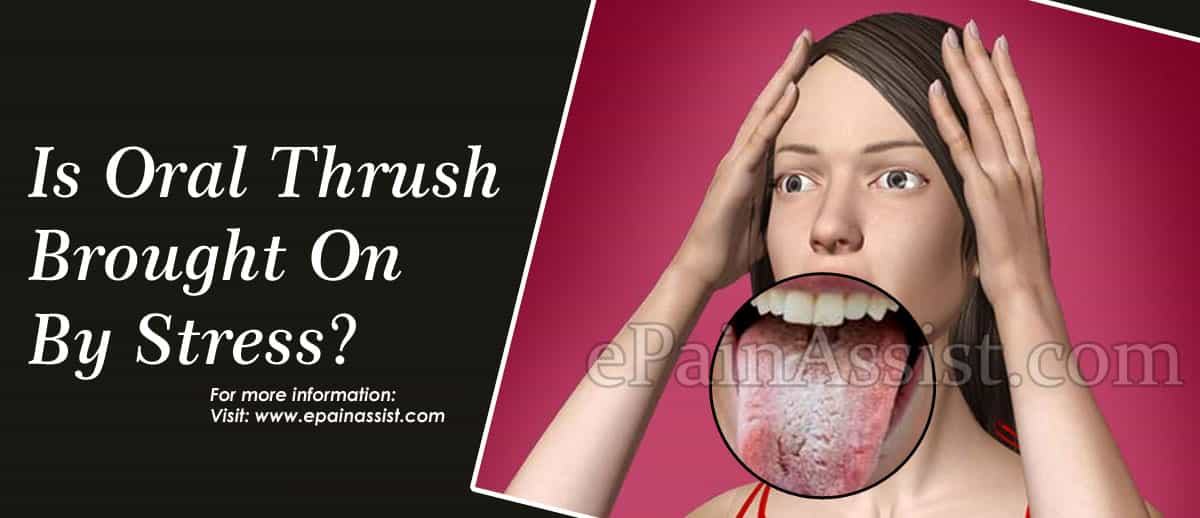 Is Oral Thrush Brought On By Stress?