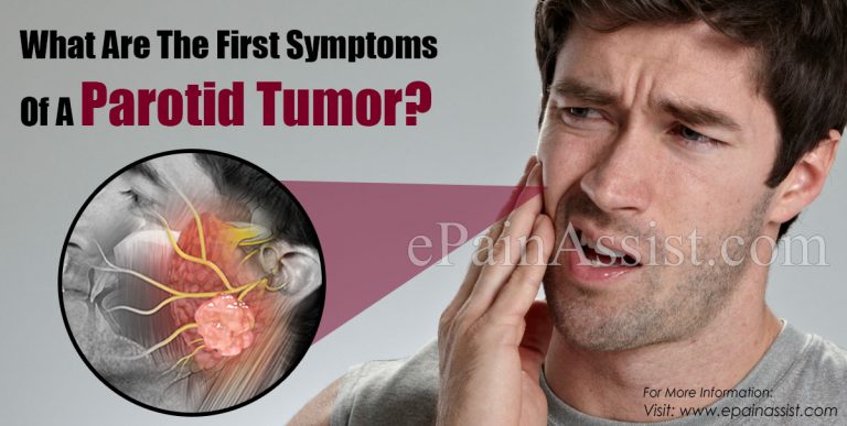 What Are The First Symptoms Of A Parotid Tumor & How Do You Test For It?