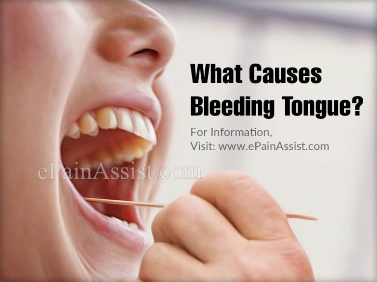 What Causes Bleeding Tongue & What is its Treatment, Home Remedies?