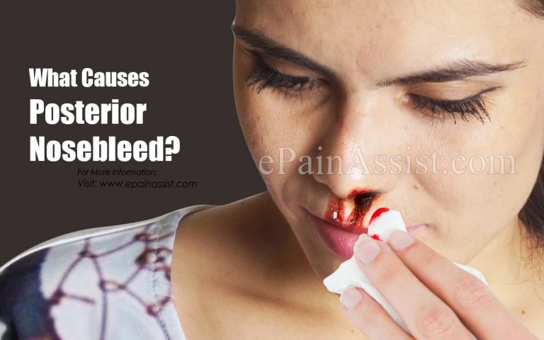 What Causes Posterior Nosebleed & How To Stop It?