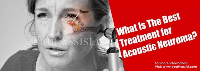 What Is The Best Treatment for Acoustic Neuroma?