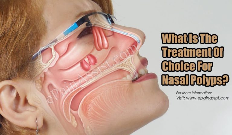 What Is The Treatment Of Choice For Nasal Polyps?