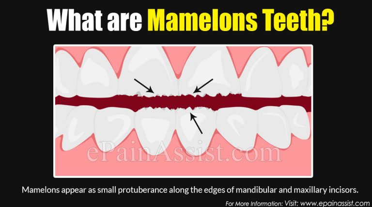 What Are Mamelons Teeth?