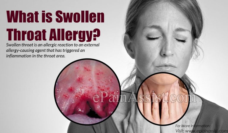 What is Swollen Throat Allergy & How is it Treated?