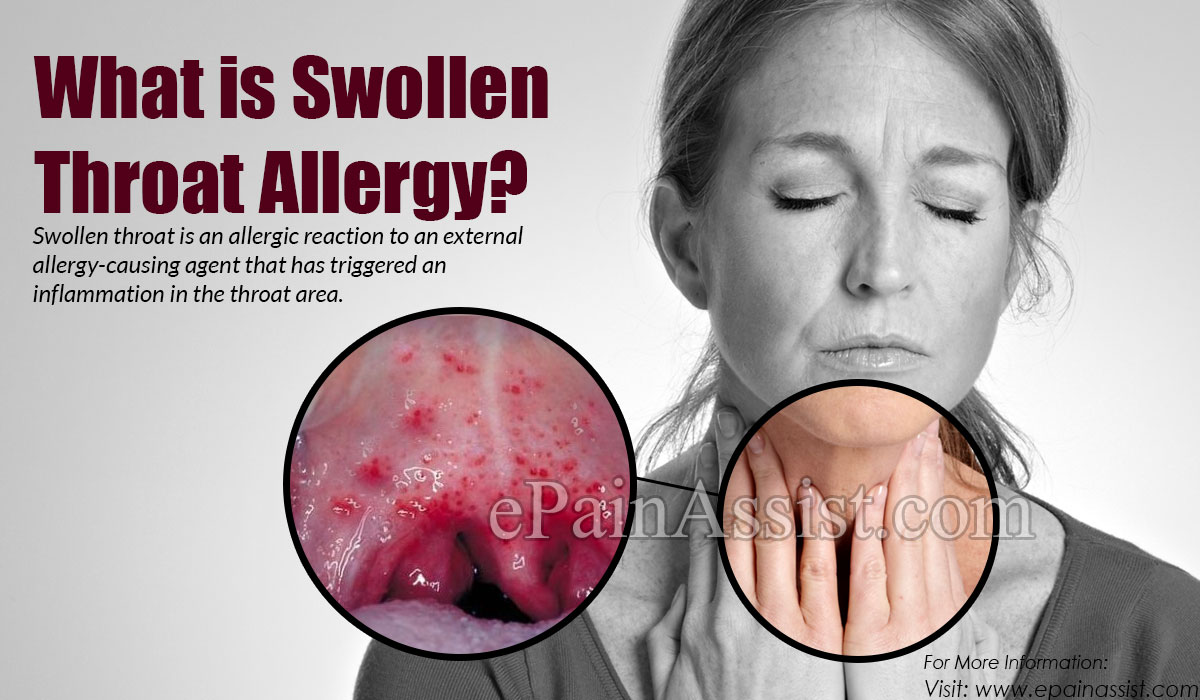 What is Swollen Throat Allergy?