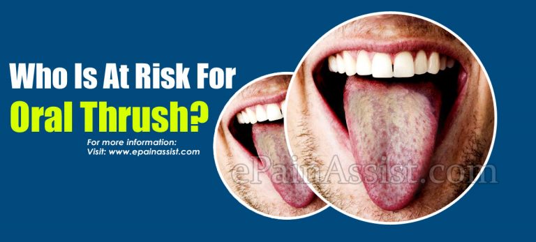 Who Is At Risk For Oral Thrush & Is There A Test For It?