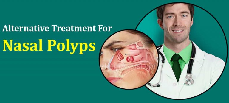 Alternative Treatment For Nasal Polyps & Is It A Progressive Disease?