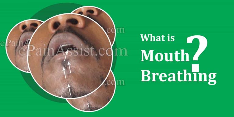 What are the Causes of Mouth Breathing & How is it Treated?