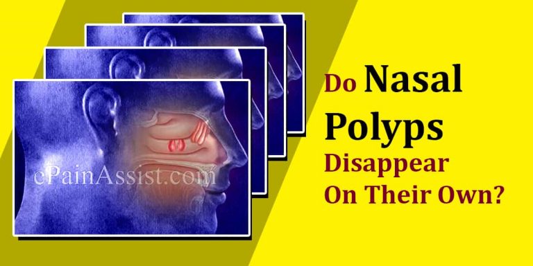 Do Nasal Polyps Disappear On Their Own & What Are It’s Natural Remedies?