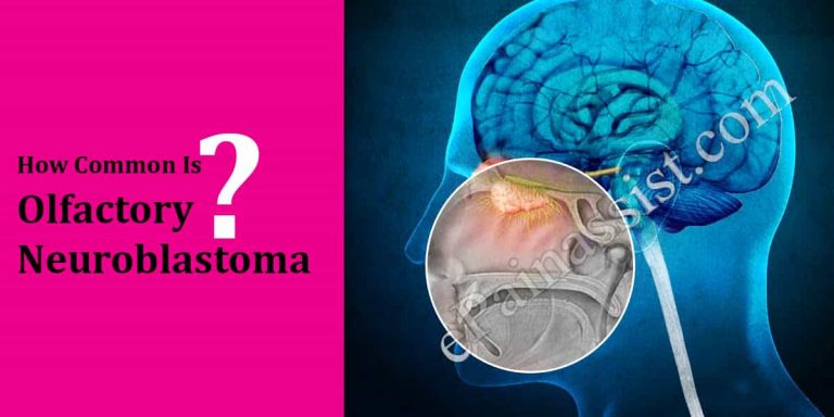 How Common Is Olfactory Neuroblastoma Or Is It A Rare Disease?