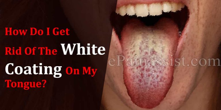 How Do I Get Rid Of The White Coating On My Tongue?