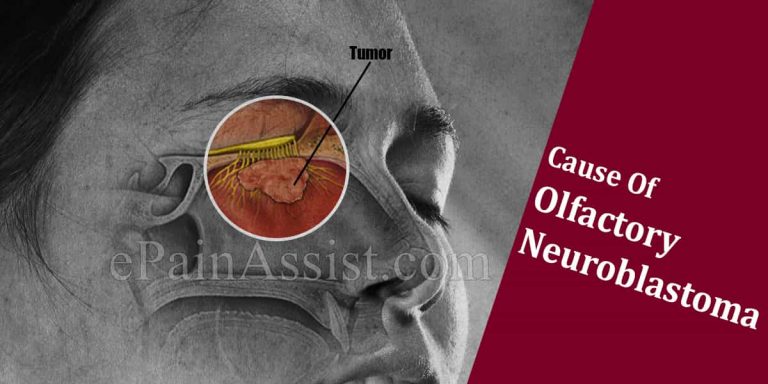 How Long Will It Take To Recover From Olfactory Neuroblastoma & How Long Does The Symptoms Last?