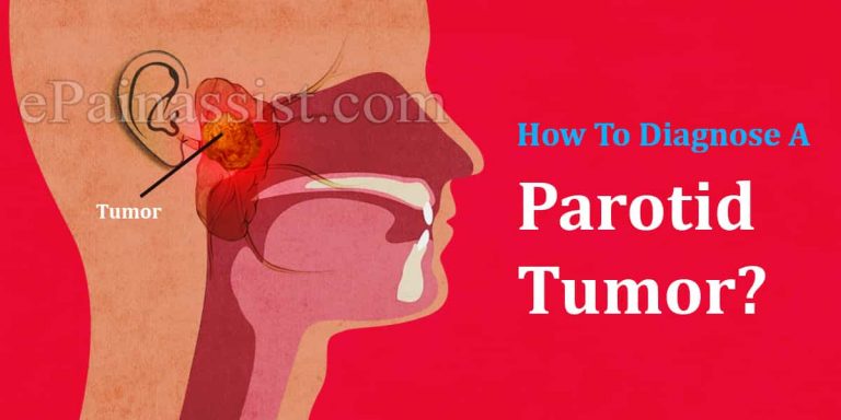 How To Diagnose A Parotid Tumor & What Is The Best Medicine For It?