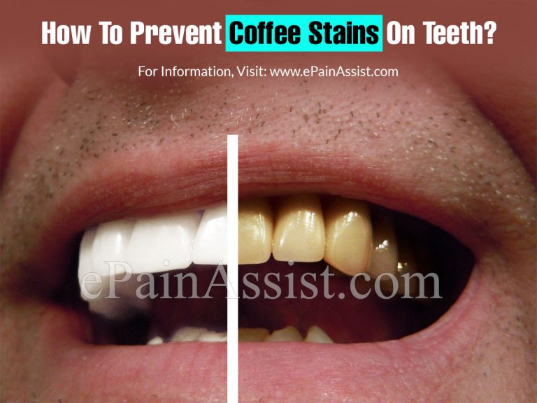 How To Prevent Coffee Stains On Teeth?