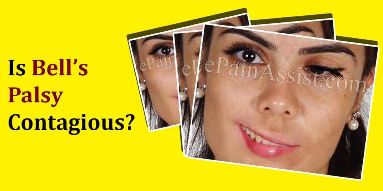 Is Bell’s Palsy Contagious?