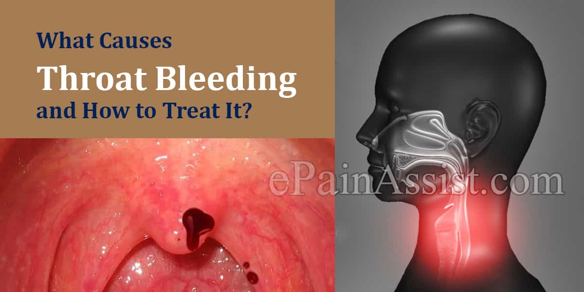 What Can Cause Throat Bleeding & How Is It Treated?