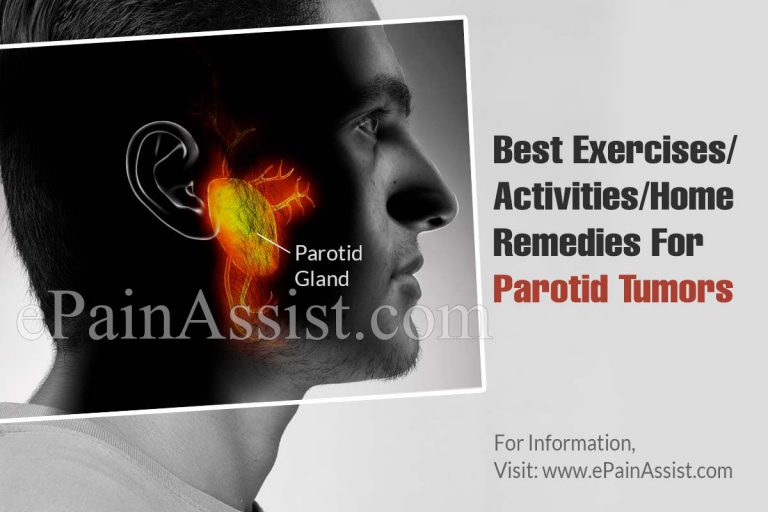Best Exercises/Activities/Home Remedies For Parotid Tumors