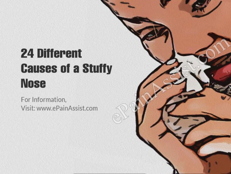 24 Different Causes of a Stuffy Nose
