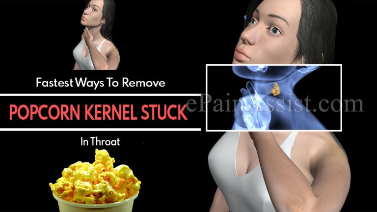 Fastest Ways To Remove Popcorn Kernel Stuck In Throat