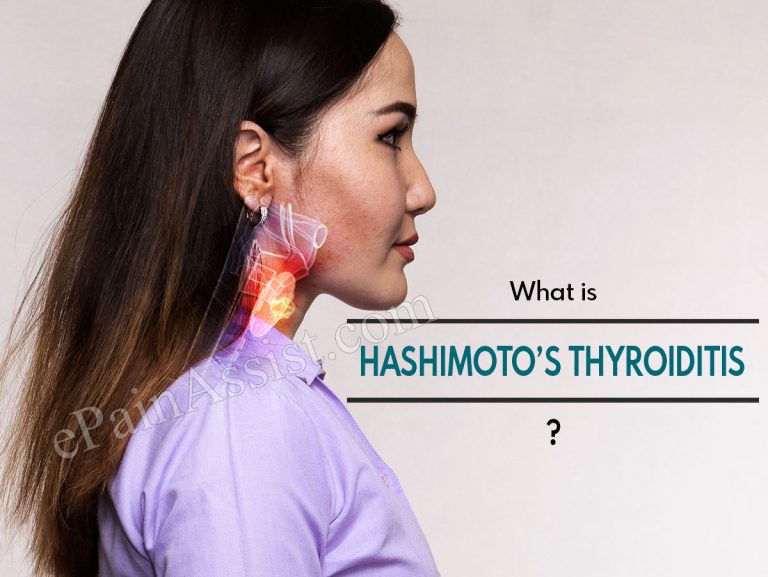 Hashimoto’s Thyroiditis: Diets, Supplements and Lifestyle Modifications to Manage Hashimoto’s Thyroiditis
