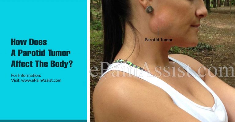 How Does A Parotid Tumor Affect The Body & What Triggers It?