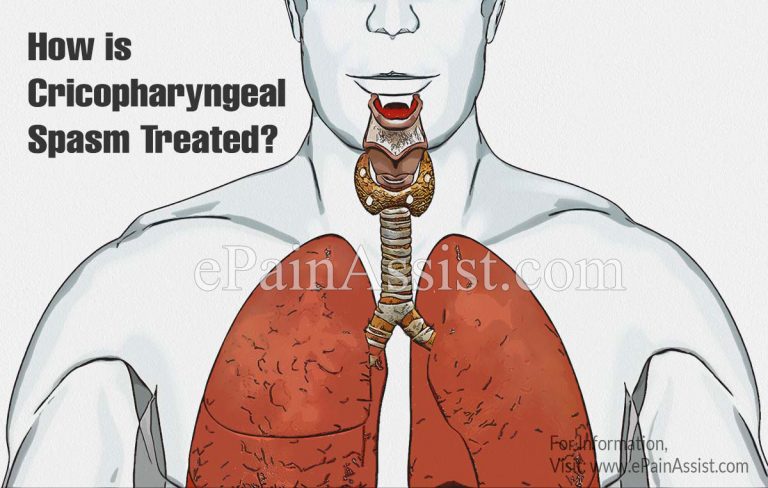 Cricopharyngeal Spasm: Causes, Symptoms, Treatment, Prevention