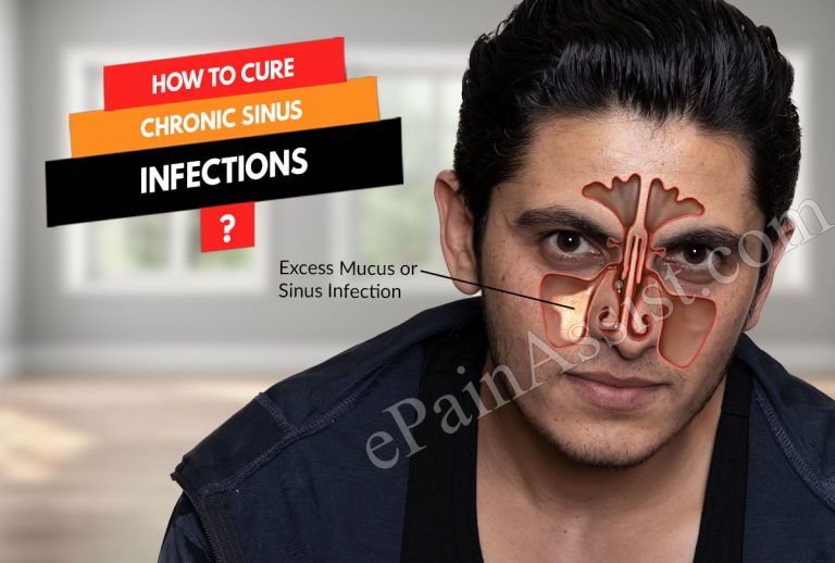 How To Cure Chronic Sinus Infections?