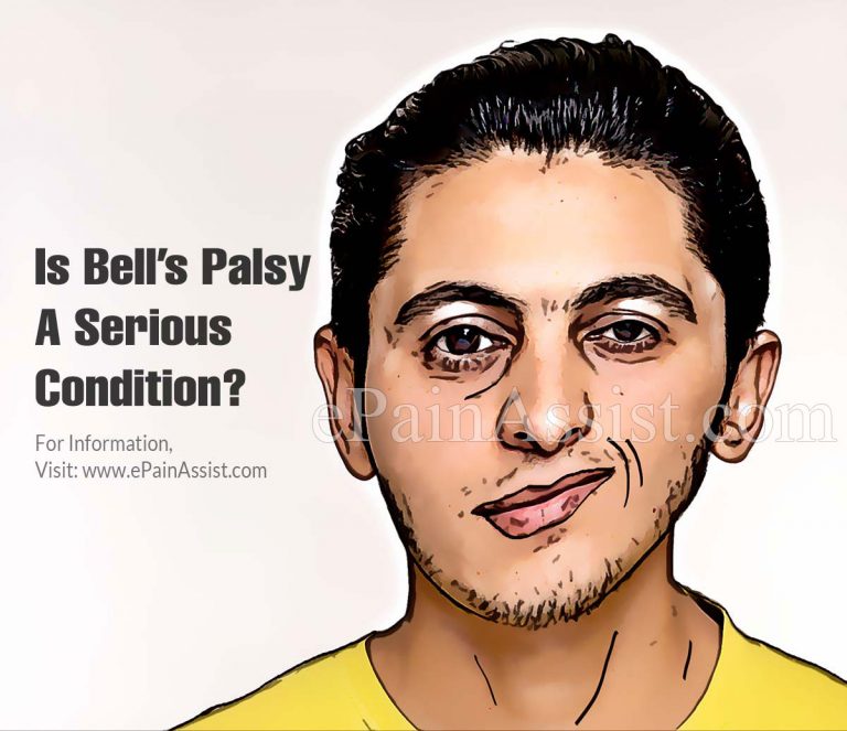 Is Bell’s Palsy A Serious Condition & Can It Be Reversed?
