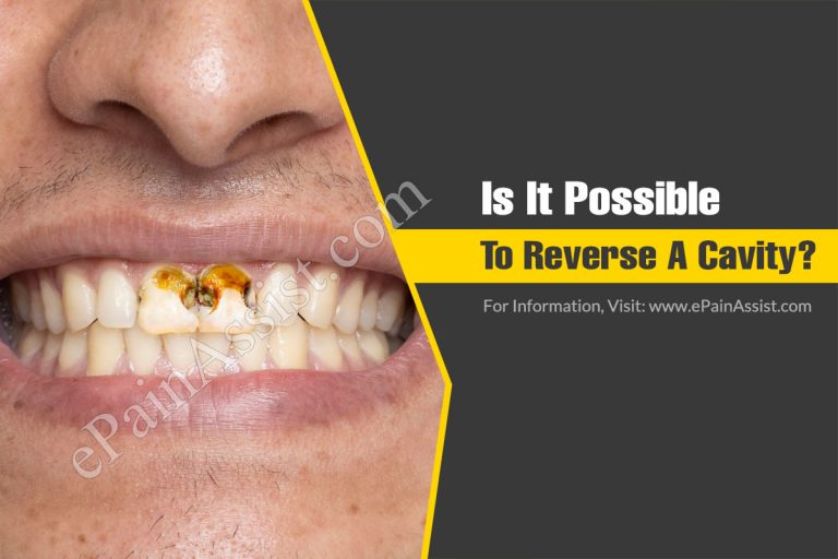 Is It Possible To Reverse A Cavity?