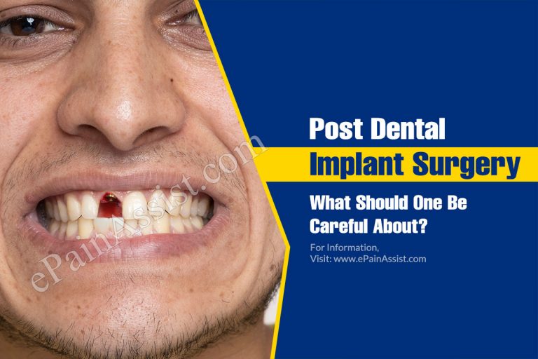 Post Dental Implant Surgery: What Should One Be Careful About?
