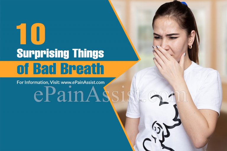 10 Surprising Things of Bad Breath