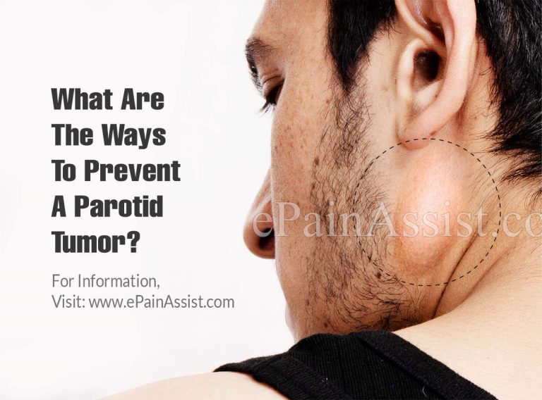 What Are The Ways To Prevent A Parotid Tumor & Does It Recur?