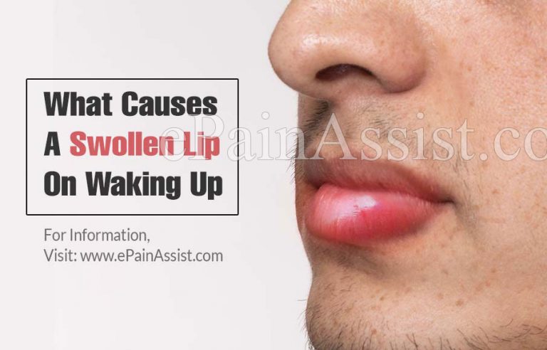 What Causes A Swollen Lip On Waking Up And What Can Be Done About It?